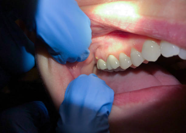 Best Cracked Tooth Emergency Dentist  in Winters, TX