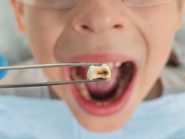 Best Cracked Tooth Emergency Dentist  in Winters, TX